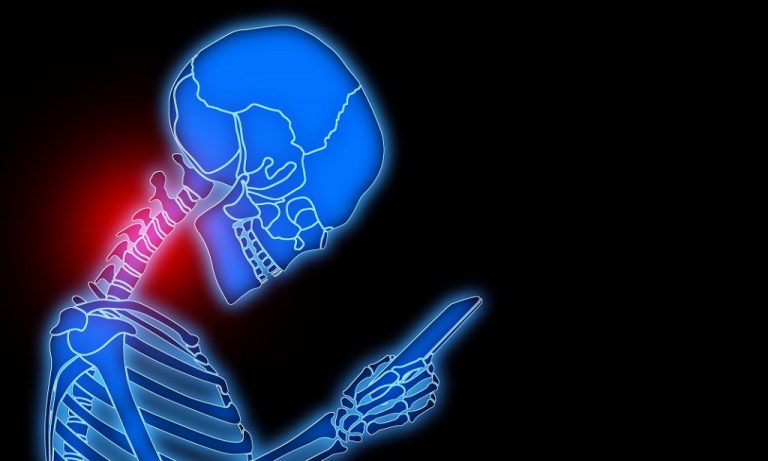Text Neck Syndrome