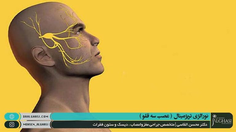 نورالژی تری ژمینال و درمان آن