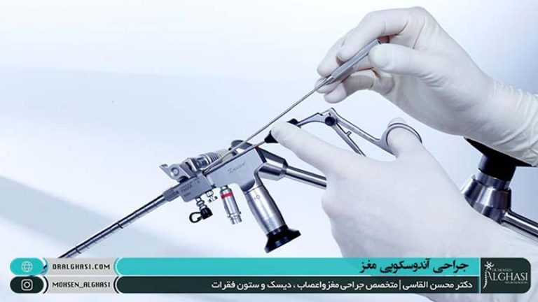 جراحی آندوسکوپی مغز