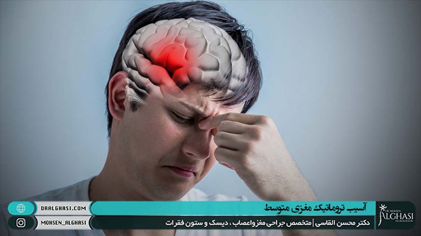 آسیب تروماتیک مغزی متوسط