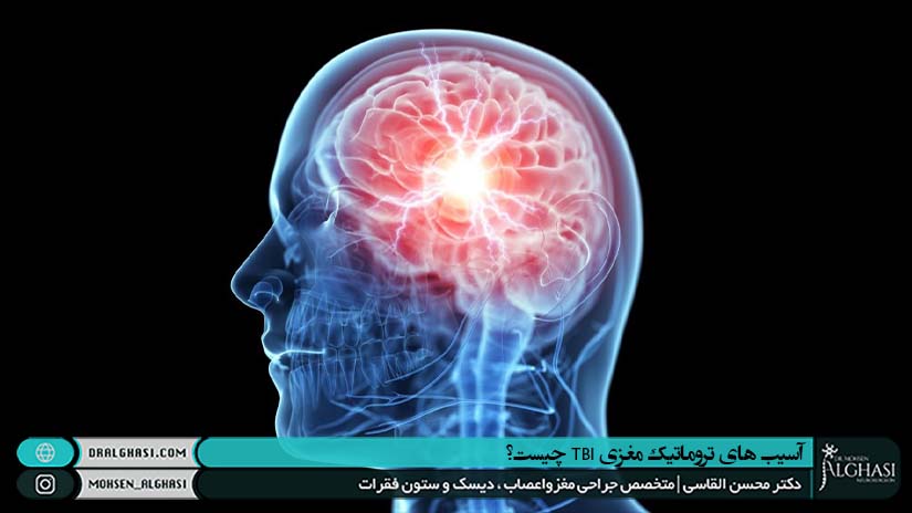 آسیب های تروماتیک مغزی TBI چیست؟