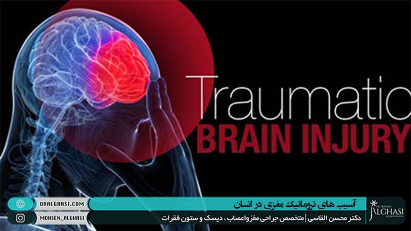 آسیب های تروماتیک مغزی
