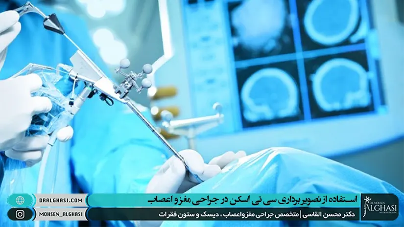 استفاده از سی تی اسکن در جراحی مغز و اعصاب