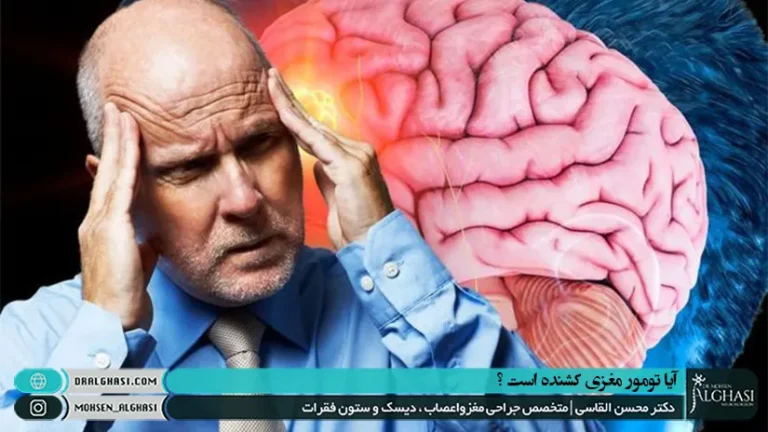 آیا تومور مغزی کشنده است؟
