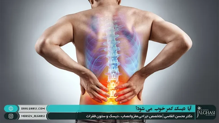 آیا دیسک کمر خوب می شود؟