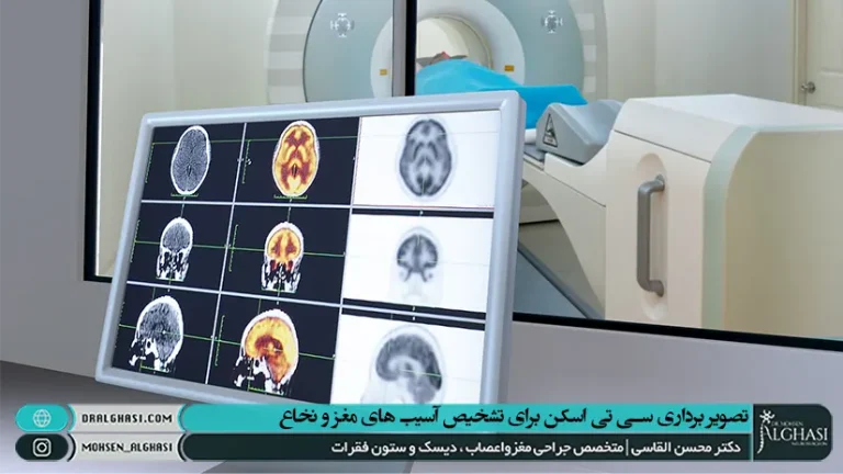 سی تی اسکن مغز و نخاع