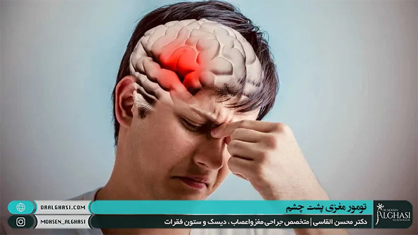 تومور مغزی پشت چشم و درمان آن