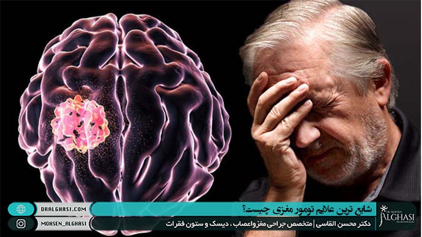 علایم تومور مغزی چیست؟