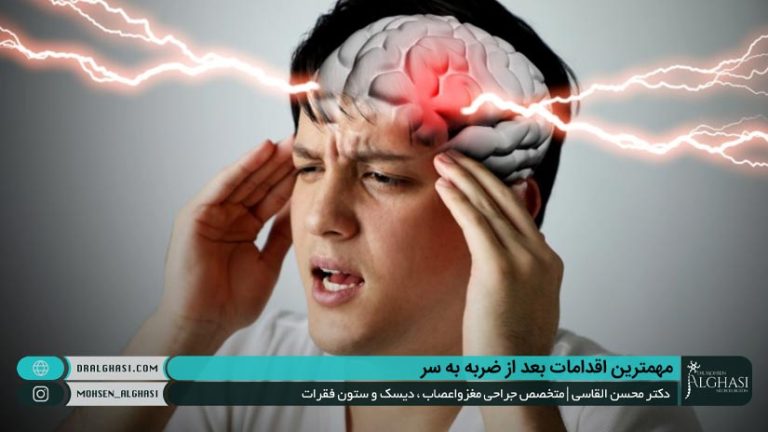 اقدامات پس از ضربه به سر