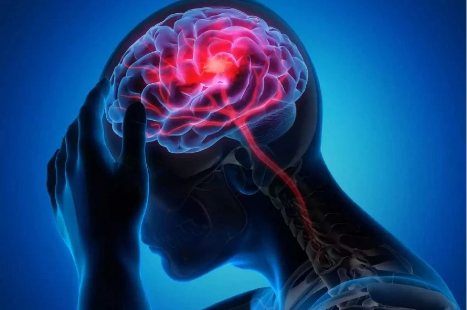 بیماری‌های مغز | درمان و پیشگیری | دکتر القاسی
