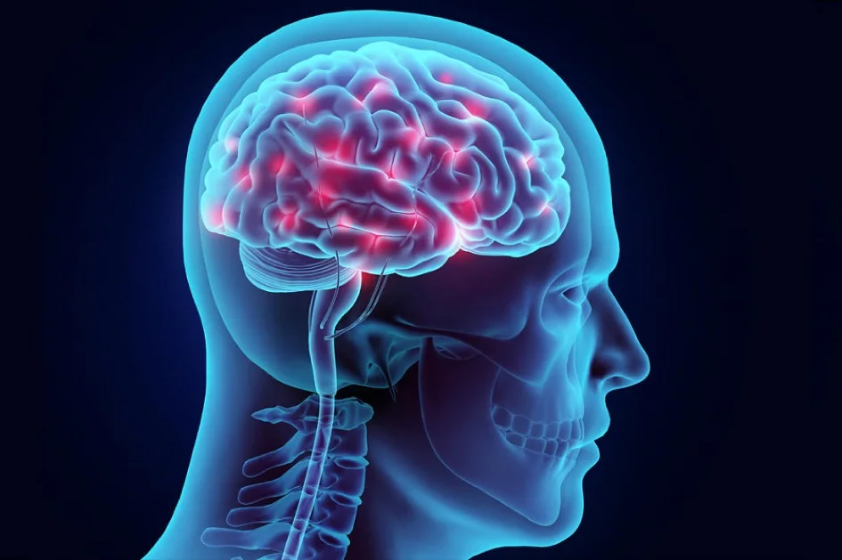 بیماری‌های مغز | بیماری کیست مغزی و روش درمان آن | دکتر القاسی