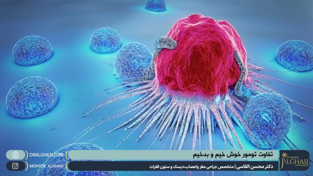تفاوت تومور خوش‌ خیم و بدخیم