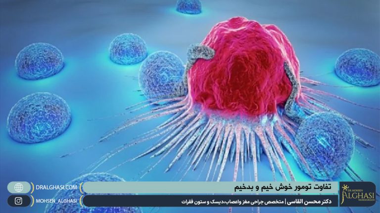 تفاوت تومور خوش خیم و بدخیم