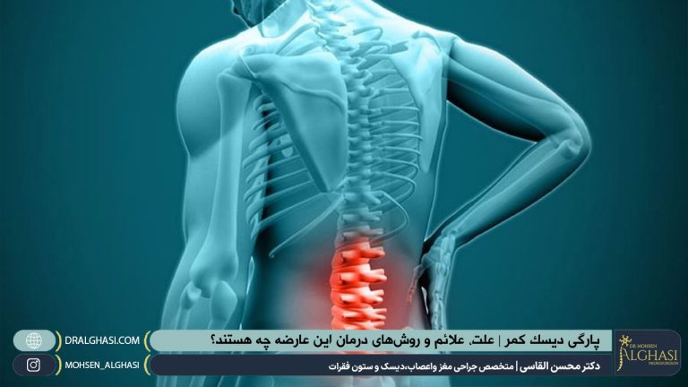 پارگی دیسک کمر | دکتر القاسی | بهترین جراح ستون فقرات